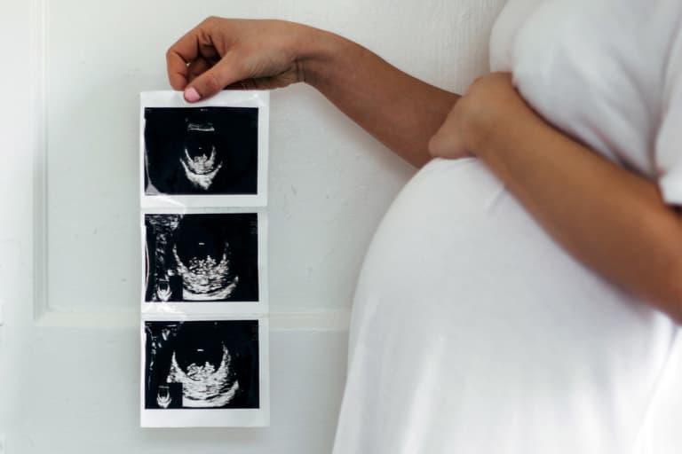Babylist product photo