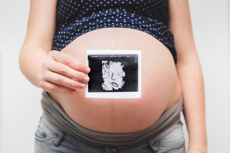 Babylist product photo